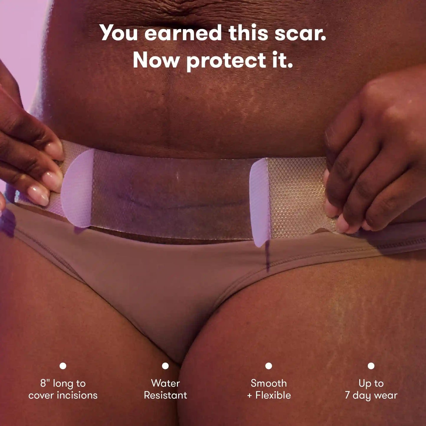 C-Section Silicone Scar Patches